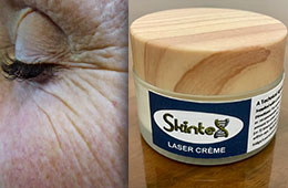anti-ageing, anti-wrinkle cream